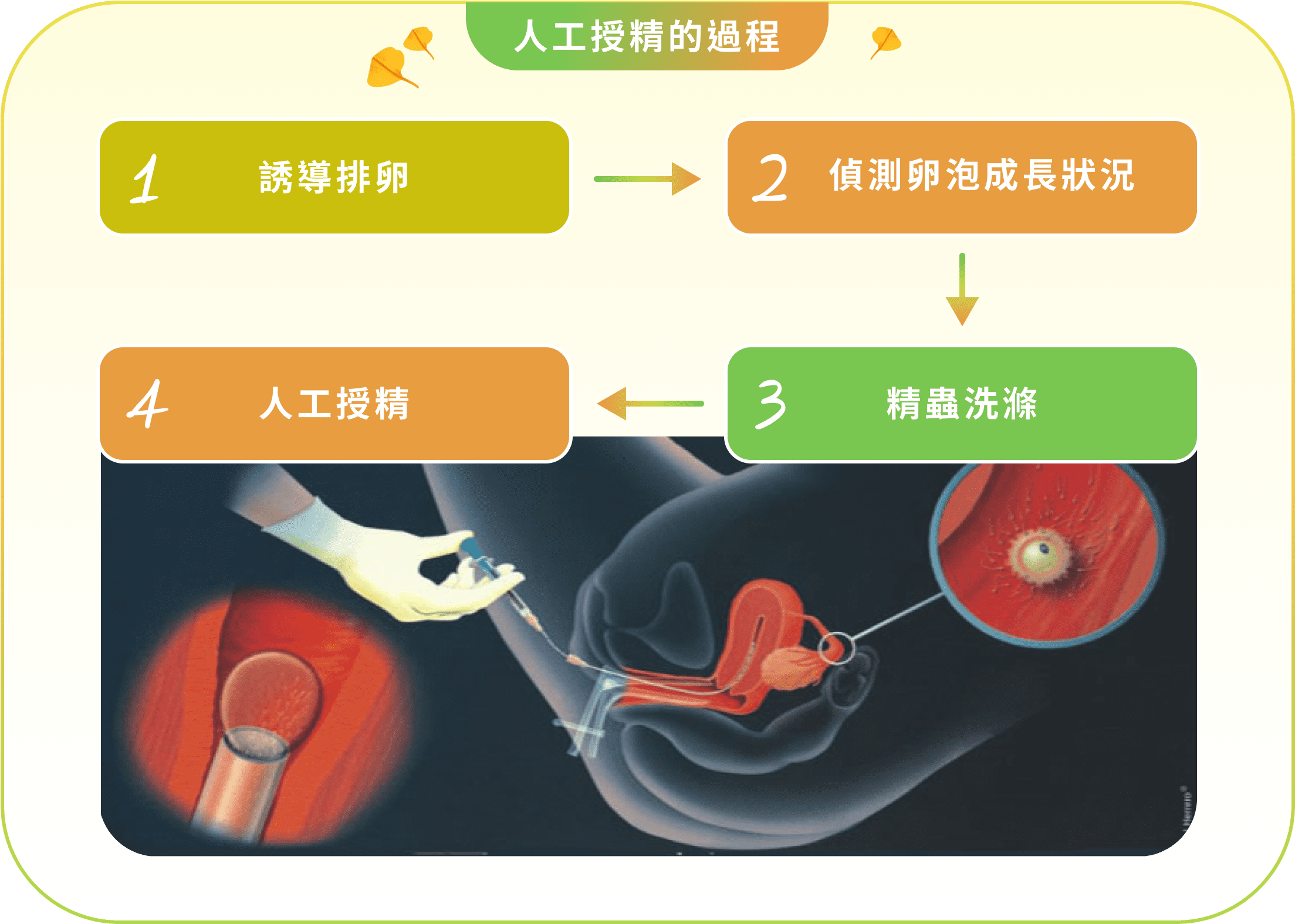 人工授精